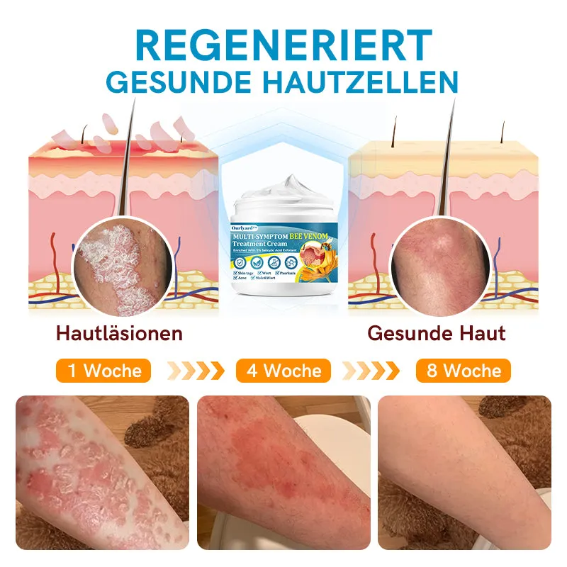 Ourlyard Multi-Symptom Bienengift Behandlungscreme